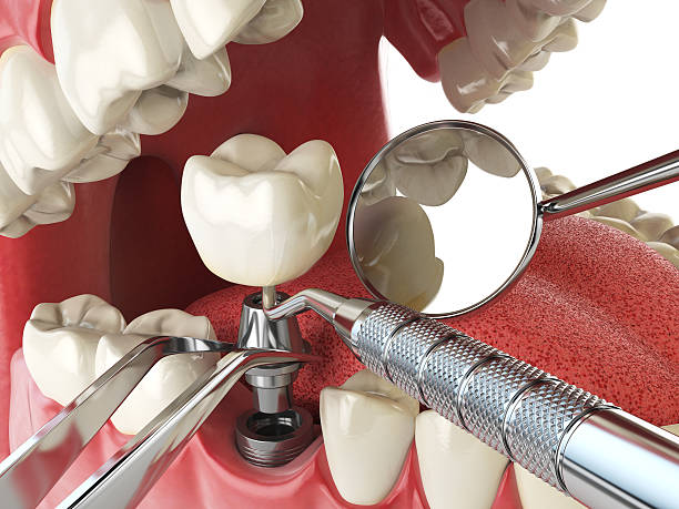Best Tooth Infection Emergency Dentist  in Lawtey, FL